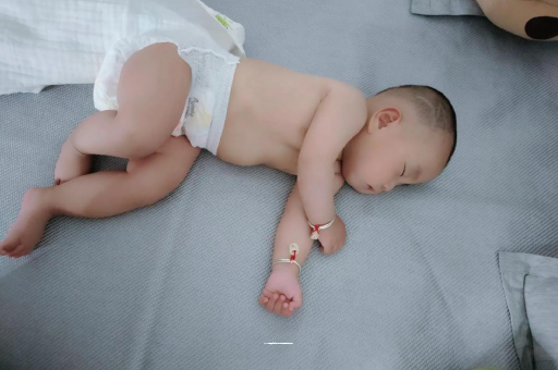 宣汉宝宝褶皱处擦粉还是油